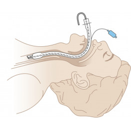 Intubating Stylet for endotracheal tubes