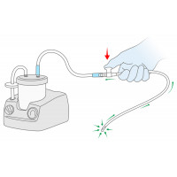 connection to the suction equipment with Thumb Control