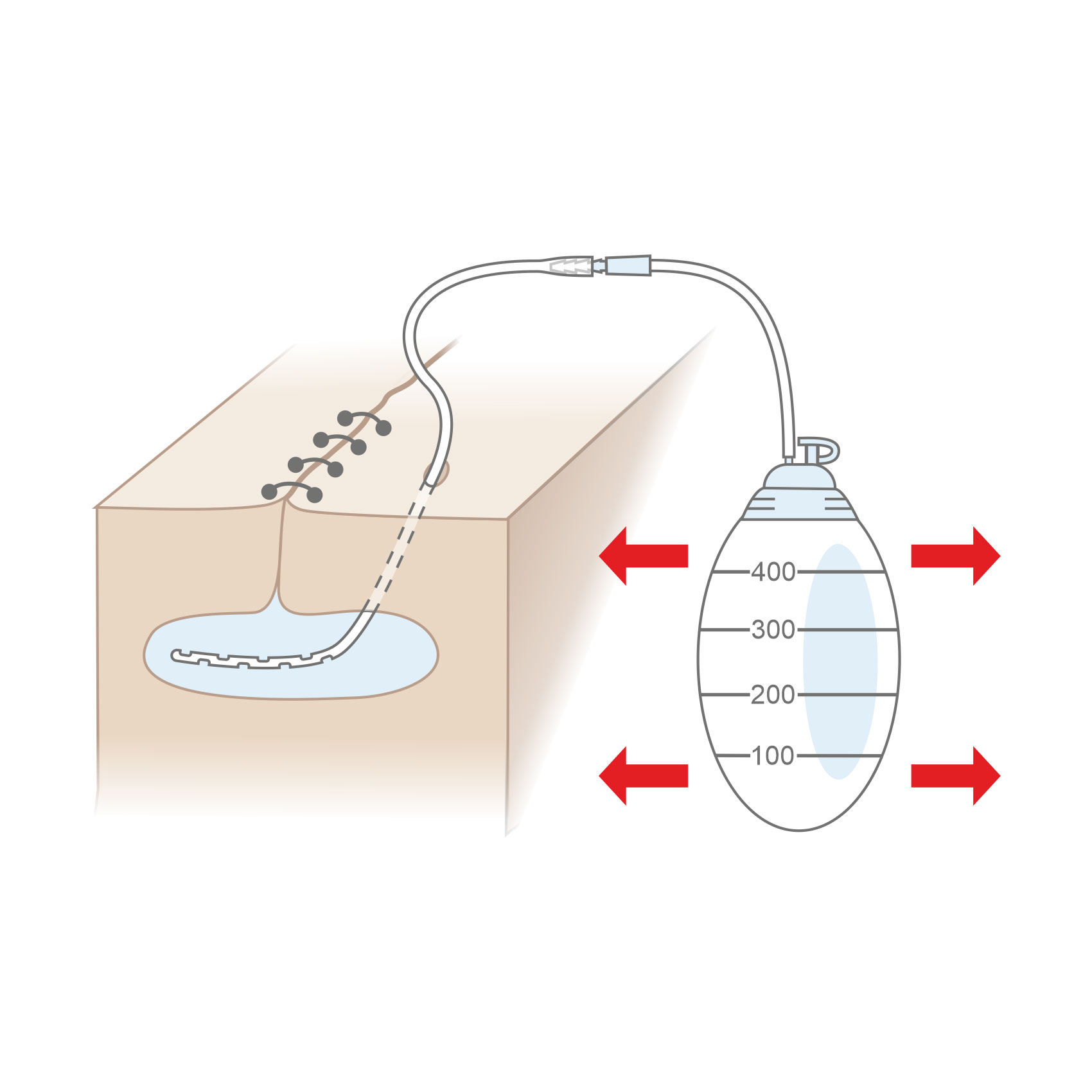 surgical wound drains