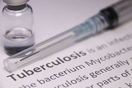 TB blood test found to predict disease two years before onset.