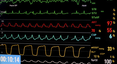 Measuring a patient’s vital signs without any contact