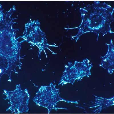 Cancer cells [illustrative]