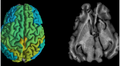 Israeli researchers develop MRI technique to detect molecular changes in brain