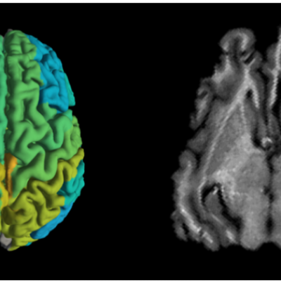 Standard MRI brain scan of a pig, right, and a new MRI scan showing differences in molecular makeup in different parts of the brain