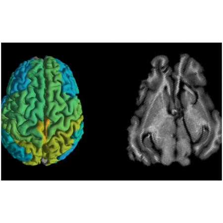 Standard MRI brain scan of a pig, right, and a new MRI scan showing differences in molecular makeup in different parts of the brain