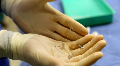 First-Ever Implant Treats Heart Failure at Rambam