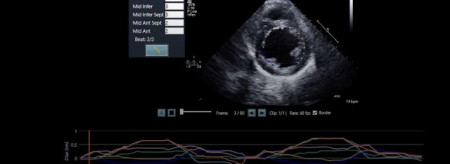 A screenshot of the LVivo Toolbox from DiA Imaging Analysis.